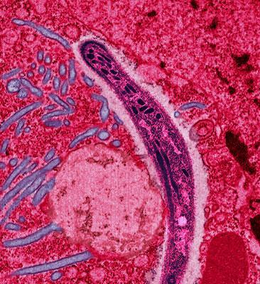 Un plasmodium, soit un organisme unicellulaire qui cause le paludisme, vu sous la lentille d’un microscope.